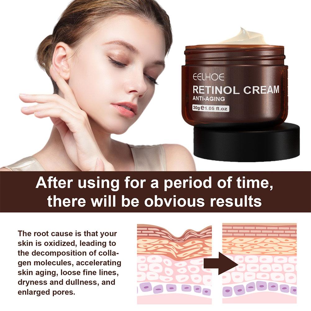 EELHOE 1/2/3/5PCS(Buy 3 Get 2  - огляд і ціна Retinol Anti Wrinkle Cream