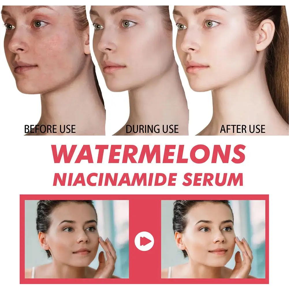 Watermelon Glow Niacinamide Mo - огляд і ціна Hyaluronic Acid Facial Serum