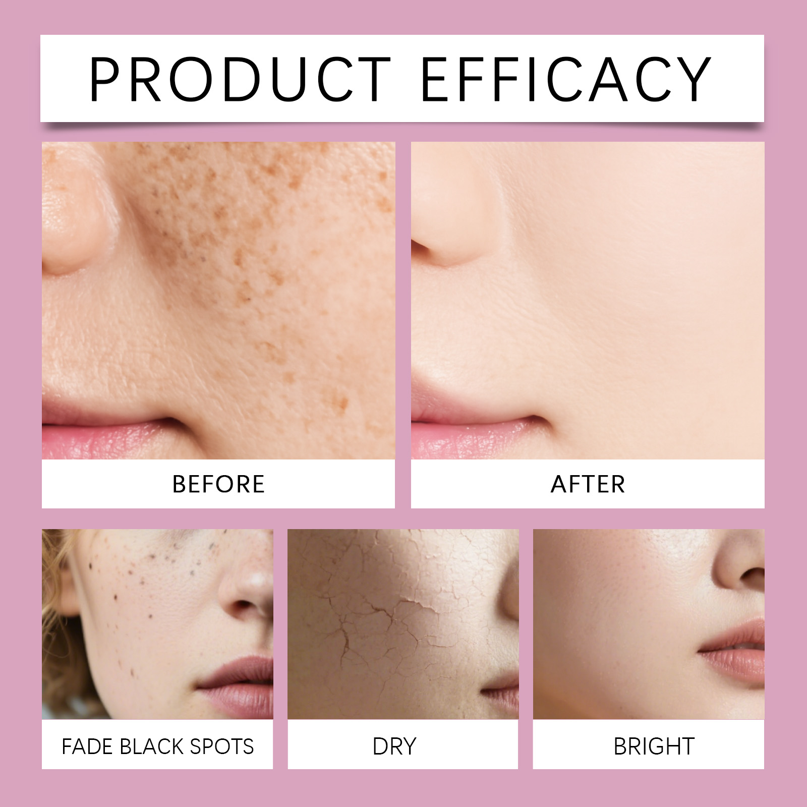 Korean Calcium Collagen Skinca - огляд і ціна Hyaluronic Acid Facial Serum
